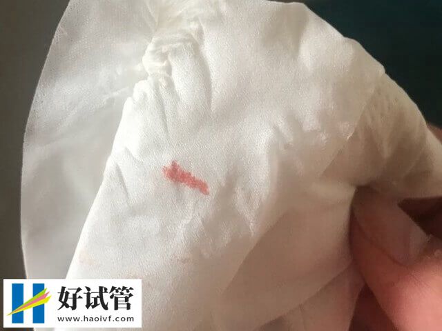 试管移植后着床有什么反应(图1)